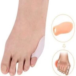 Goedkoopste ✨ Merkloos Bunionette - Kleine Teen Beschermer ⌛