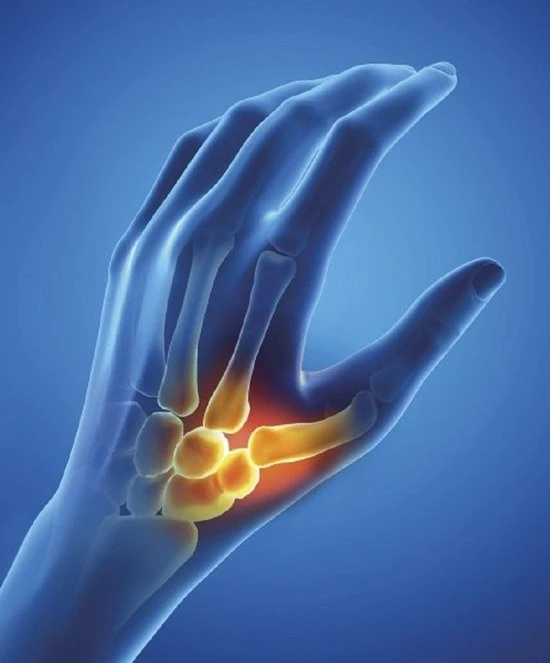 Begroting ⌛ Epitact Flexibele Duimbrace. Ondersteunt Verlicht Gewrichtspijn Rechterhand Maat M. ???? 6 Begroting ⌛ Epitact Flexibele Duimbrace. Ondersteunt Verlicht Gewrichtspijn Rechterhand Maat M. ???? - Afbeelding 6